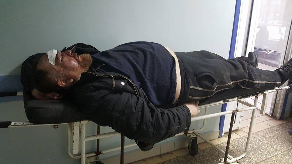 В Харькове жестоко избили вышедшего из СИЗО под залог активиста Антимайдана 