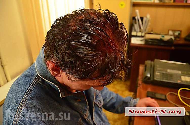 Месть за 9 мая: В Николаеве неонацисты и «атошники» напали на «афганцев» (ФОТО, ВИДЕО)