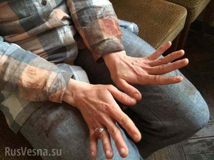 МВД Украины в расстреле чеченца, покушавшегося на Путина, обнаружило российский след (ФОТО)
