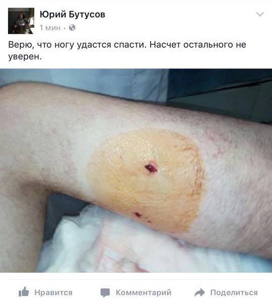 Украинский депутат-боевик проткнул ногу шампуром – его спасали на вертолёте 