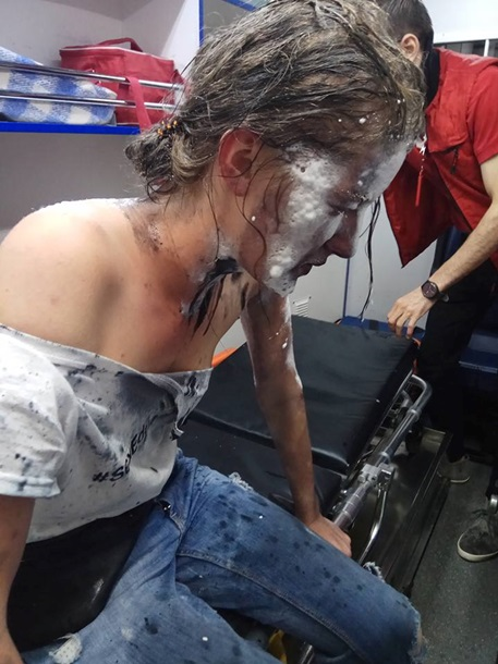 В Киеве 10 человек в масках с криками «Вот вам, пид…расы!» напали на организаторов лекции «Трансгендер» 